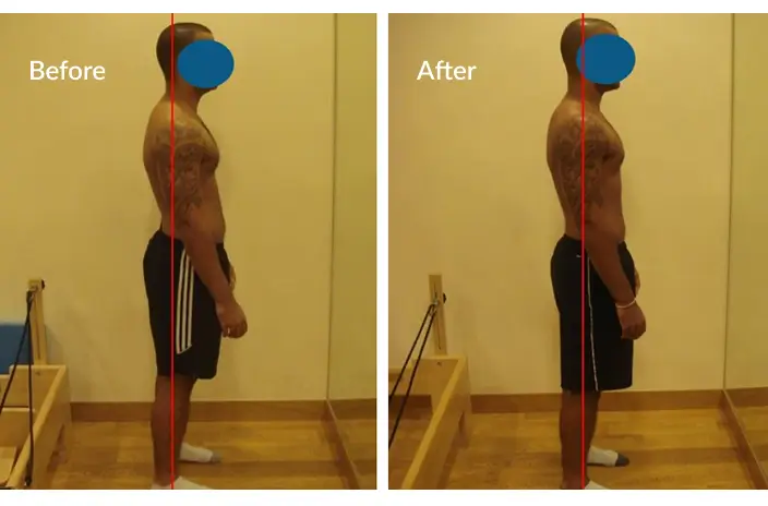 case-study-back-pain-2