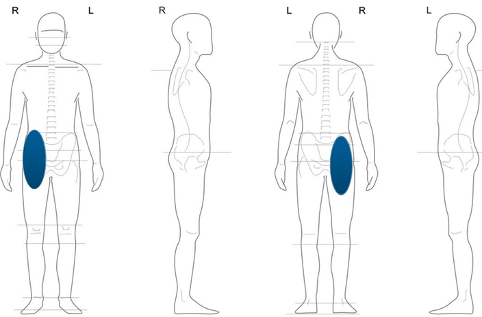 case-study-gluteal-1