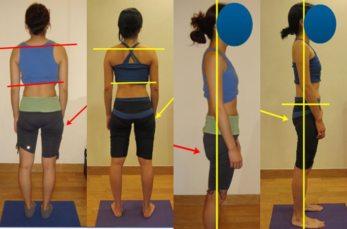 case-study-gluteal-2